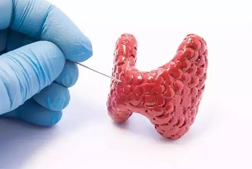 甲状腺疾病，包括甲状腺功能减退和甲状腺功能亢进，自古以来就是反复被医学研究人员研究的疾病